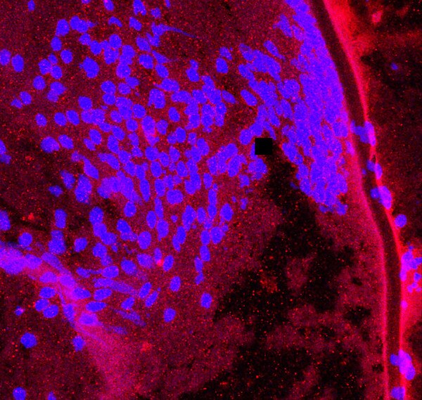 IF of P10 mouse lense labeled with DSHB antibody CPTC-EPHB4-1 aginst EPH receptor B4 (red). Image credit Lachke Laboratory, University of Delaware